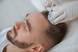 StemCellsHairGrowth.jpg